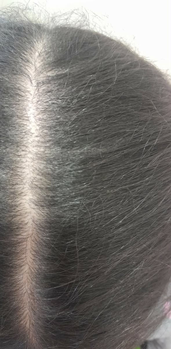 شكرا على مشاركه الصوره 🌹 🌹 🌹 🌹
💞 عياده الدكتوره ذكرى حسين التميمي
اختصاص جلديه وحساسيه و َتناسليه نسائية وليزر
بغداد البياع شارع 20 فوق عوينات السلوى
للحجز *********** او مراسله الصفحه
