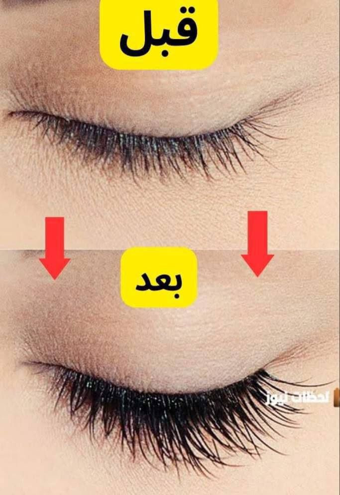 صنع سويسري 🇨🇭جودة عالية 100٪ تستحق ثقتك 😍

سيروم مافالا الفعال 100% في زيادة طول الرموش وحمايتها من التساقط بدون استعمال رموش إصطناعية♥️.
✅ مكثف ومغذي ومقوي في نفس الوقت❤️.
✅ ينصح به من قبل اطباء العيون💯💯
✅ يمكن إستعماله للرموش و الحواجب 
✅ يحفز نمو الرموش والحاجب حيث يضمن زيادة الطـــول والكــثــافــة والسّـــمــك 😍
✅ سيروم مغذي يجمع ما بين مطول للرموش و مقوي للرموش وأيضاً مكثف للرموش👁
✅ يحتوي على مواد طبيعية غنية بالفيتامينات والبروتينات حيث تعمل على تقوية وحماية رموشك وحواجبك 
✅ غنية بحمض الجليكوليك الذي يساعد بنمو الشعر وتقليل تساقطه بالاضافة الى انها خالية من الزيوت 
المعدنية والبارابين والعطور والمواد الضارة..
✅ لايسبب تهيج للبشرة الحساسة التي حول العين


**إذا كنت صاحب هذا الإعلان وتريد حذفه لأي سبب، رجاءا أرسل رسالة إلى الدعم الفني**