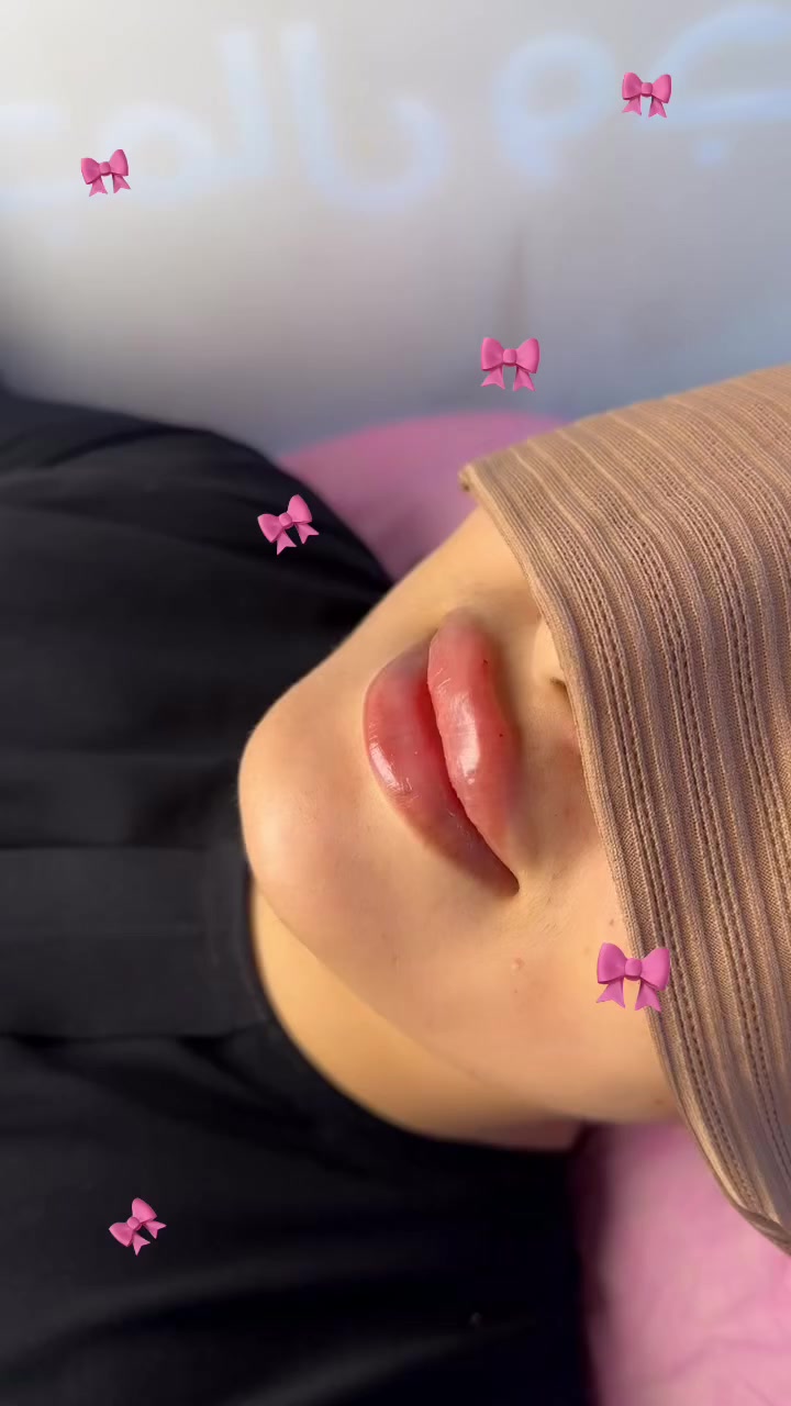 🤭🤭🎀✨🎀🎀💅🏻💅🏻💅🏻


**إذا كنت صاحب هذا الإعلان وتريد حذفه لأي سبب، رجاءا أرسل رسالة إلى الدعم الفني**