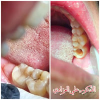 عيادة كوثى • تجميل اسنان • جبله