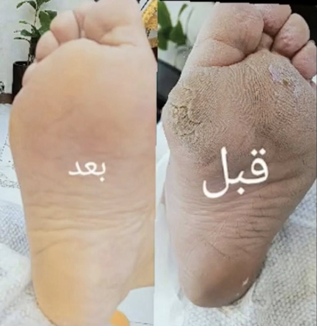 مستمره عروضات العيد من لمسة خيال ❤️

تنظيف قدم ملكي 15
تنظيف يد ملكي 10

 العنوان موصل حي الوحده سايدين مقابل جامع الصابرين 
( جامع الشيخ عبد القادر الكيلاني ) للحجز خاص أو الاتصال ع الرقم 
***********
