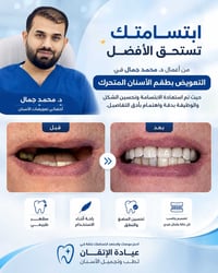 طقم أسنان متحرك • عيادة الإتقان • الطوبجي مقابل كوكتيل