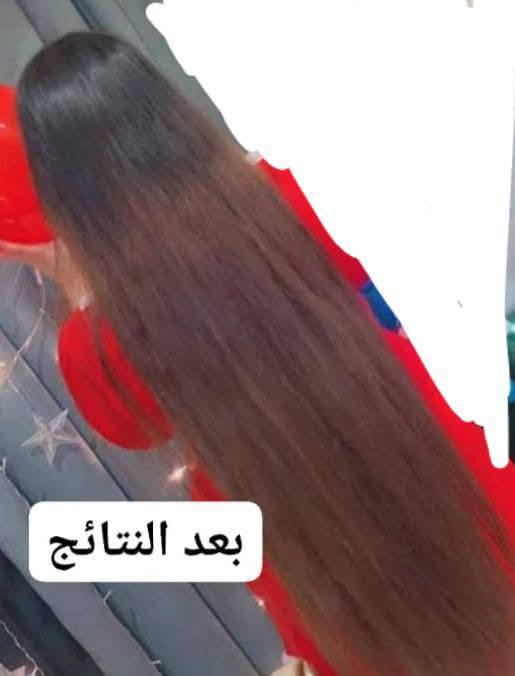 ياجمالوا بكج الشعر وشلون بخلي الشعر كله حيويه ويجننننننننن 
قبل وبعد وهاي جدامكم الصور شلون تجنننن 😁🥰😍


**إذا كنت صاحب هذا الإعلان وتريد حذفه لأي سبب، رجاءا أرسل رسالة إلى الدعم الفني**