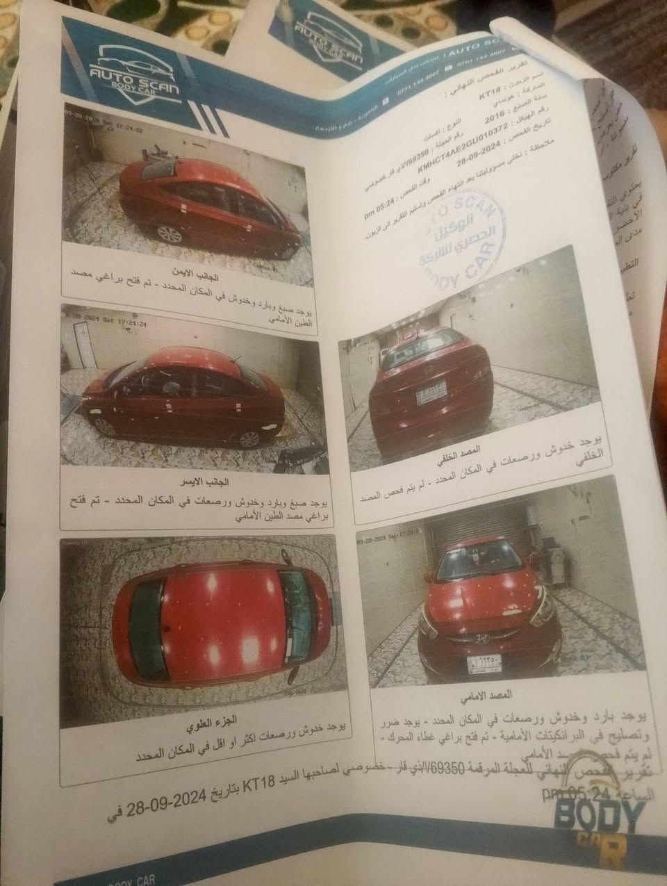 سلام عليكم أكسنت موديل 16امريكي كفاله عامه مكينه وكير كارتون ستخدام شخصي سياره مال جناي تبريد تدفئه حداديه اي نقص مابيه سياره ربع ماتصرف عليه مكاني ناصريه مركز السعر97بيه مجال قليل *********** سوناره واضح بلصور
