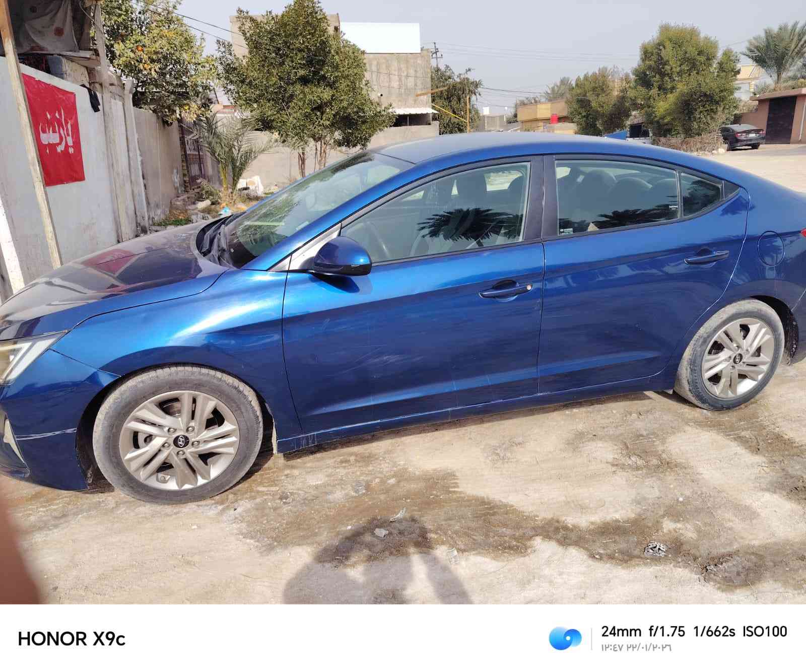 سلام عليكم النترا مديل 20
رقم بابل سياره فول عده فتحه و بصمه
وارد امريكي محرك 2000 كير ايتي 6نمر
كير مكينه وضع شركه سياره كلين السعر 143
مكلف بل نشر ***********/ مكلف بل نشر اتصل عل رقم لاتراسلني
