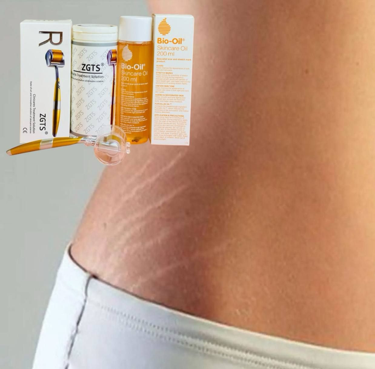 وداعاً للخطوط الحمراء والبيضاء واهلاً ببشرة كالحرير بدون خطوط ...
وياي بكجانا راح نخليج تتخلصين من الاحراج وتعيدين الثقة بنفسج المنتج اصلي وشرط الفحص وقابل للترجيع ...
أين كان نوع التشققات حمراء_بيضاء صارت عندج بسبب الحمل_السمنه_اثار حروق_ندوب كل هل مشاكل نعالجها بكج يتكون من:

🧖‍♀️ أولاً: ديرمارول الأصلية 💯
تساعد على تجديد خلايا البشرة وتحفيز الكولاجين، وفوائدها:
✅ تقليل التشققات وعلامات التمدد
✅ تحسين مرونة وملمس الجلد
✅ تصغير المسام
✅ تخفيف آثار حب الشباب والندوب
✅ تقليل الخطوط والتجاعيد
🌿 ثانياً: زيت بايو أويل الأصلي 💯💯
زيت فعال لتحسين مظهر البشرة:
✅ تقليل التشققات والخطوط البيضاء
✅ توحيد لون البشرة والتصبغات
✅ تحسين آثار الندوب والحروق
✅ ترطيب البشرة الجافة ومنحها نعومة


**إذا كنت صاحب هذا الإعلان وتريد حذفه لأي سبب، رجاءا أرسل رسالة إلى الدعم الفني**