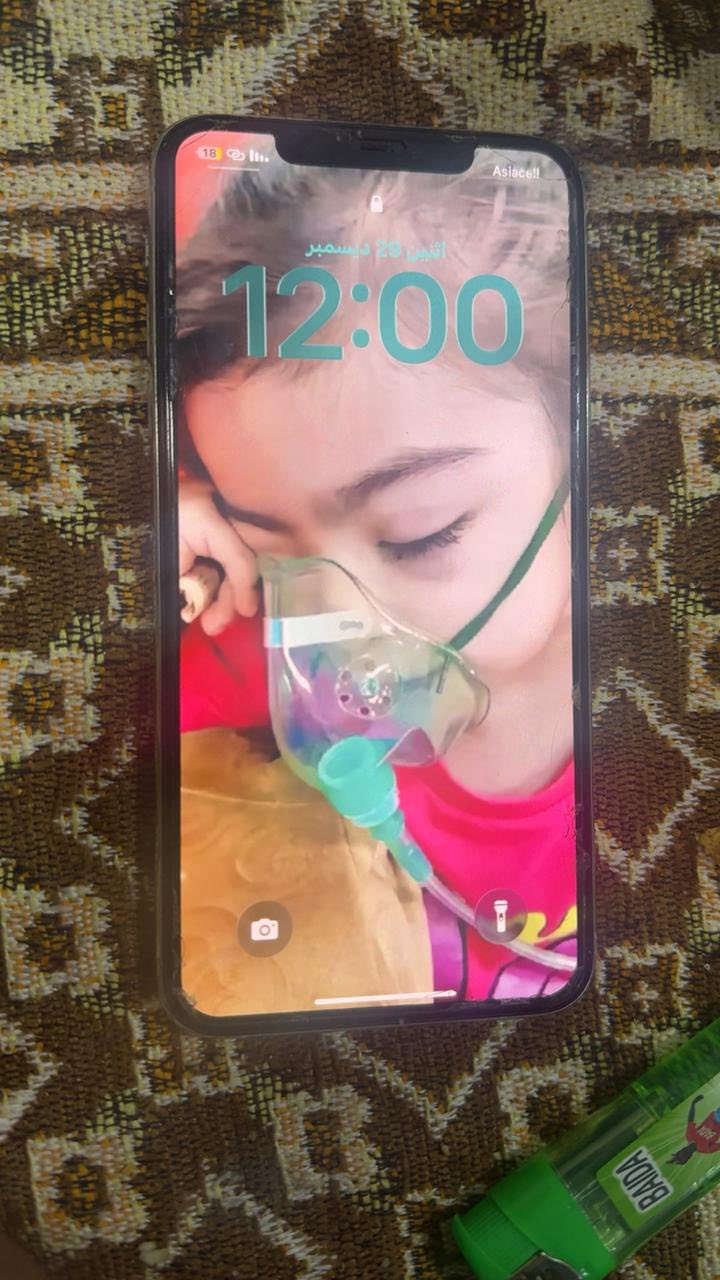 11برو ماكس ذاكره 256 البطاريه 84 فيس إيدي شغال الجهاز جديد كلش ماعده فطر زغير نفس ما مئشر بصوره بدون ملحقات السعر 300 
***********
