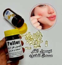 فيلر زيتي • تسمين الوجه • خدود تفاحات