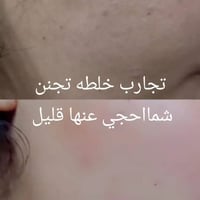تبييض الوجه • نضارة واشراق • فيتامين E و C