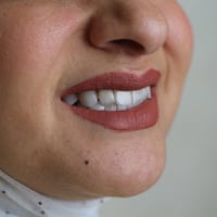 عيادة دكتور محمد يوسف لطب الاسنان نهاية شارع الدور العريض مقابل متوسطة...