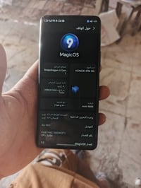 هونر X9b • هونر 5G • هونر X9b 5G • هونر مستعمل • هونر شاشة مكسورة • هو...