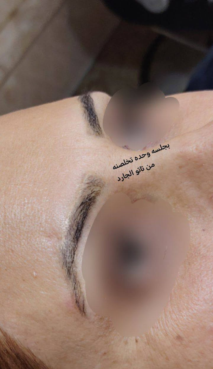 والاستفسار على الواتساب 👈 ***********
عروض مستمره لجميع انواع (آلتہآتہؤ)
وزلاله المسح تہآتہؤ//الغير مرغوب بي 

استغلن العروض  
والاستفسار على الواتساب 👈 ***********

السماوه حي الحسين خلف مطعم بوليفارد----المدربة التاتو ام محمد
صالون ورده؟🥀🥀🥀بغداد 
؟-----------------------------

؟-----------------------------

