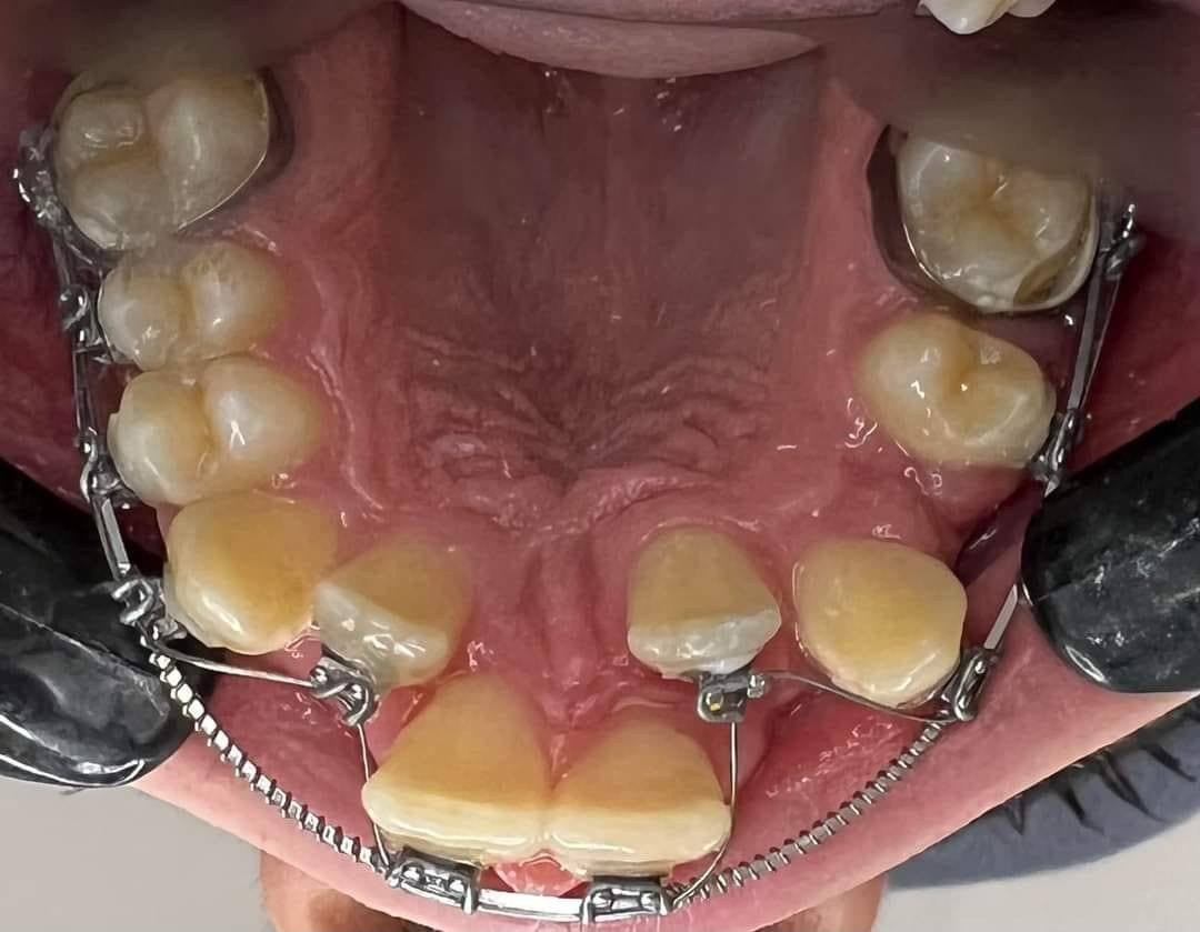 عياده الدكتور عماد عطا الله البدري
لزراعه وتقويم الاسنان رقم عياده ***********
