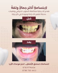 بشرى سارة 🌿  إلى أهالي الغزالية الكرام:  يسرّنا إعلامكم بـ اعلان عروض ...