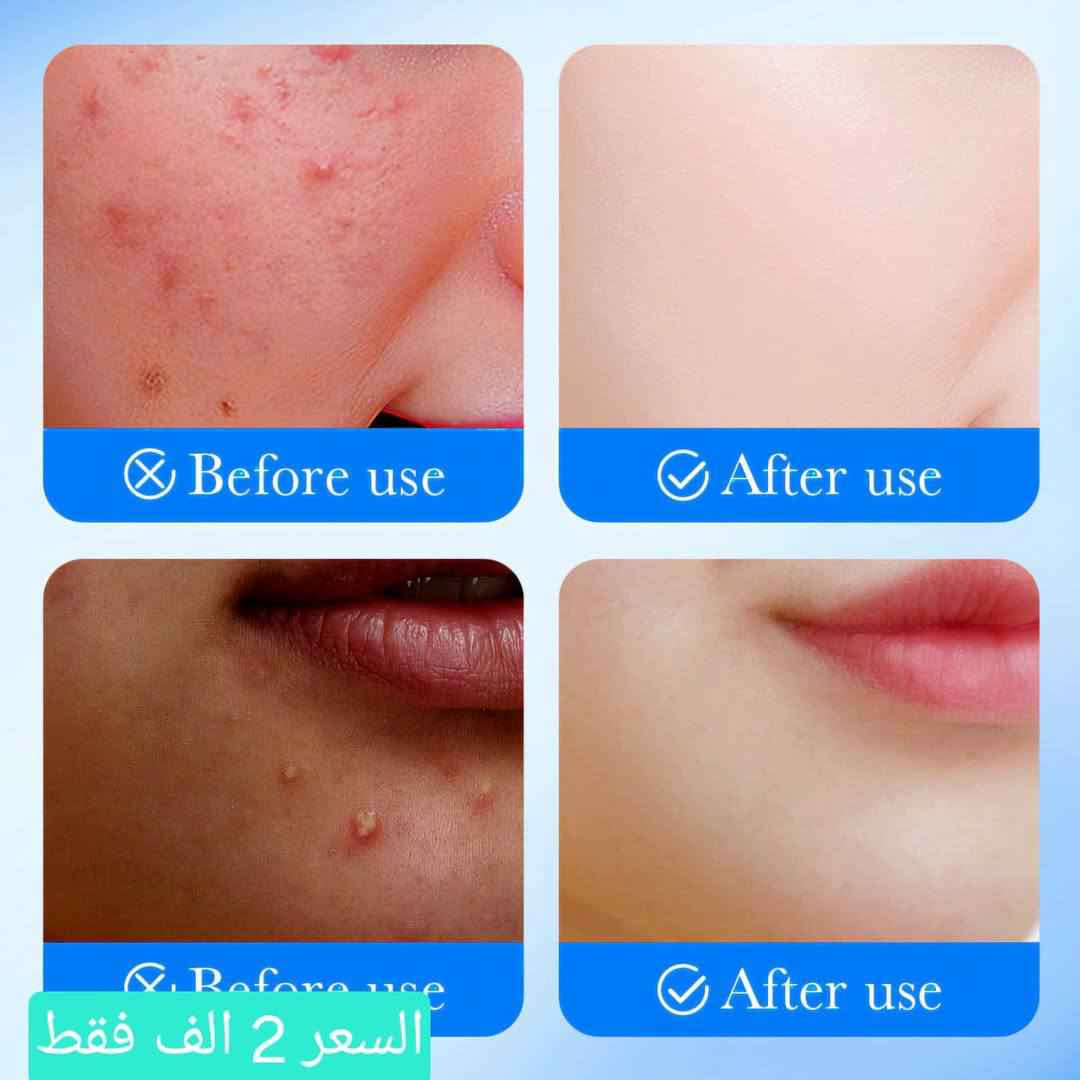 ‎لاصقات  الساليسليك اسد الحبوب‎ البصرة, العراق


**إذا كنت صاحب هذا الإعلان وتريد حذفه لأي سبب، رجاءا أرسل رسالة إلى الدعم الفني**