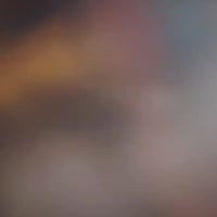 ستوته • مديل 2016 • غماس