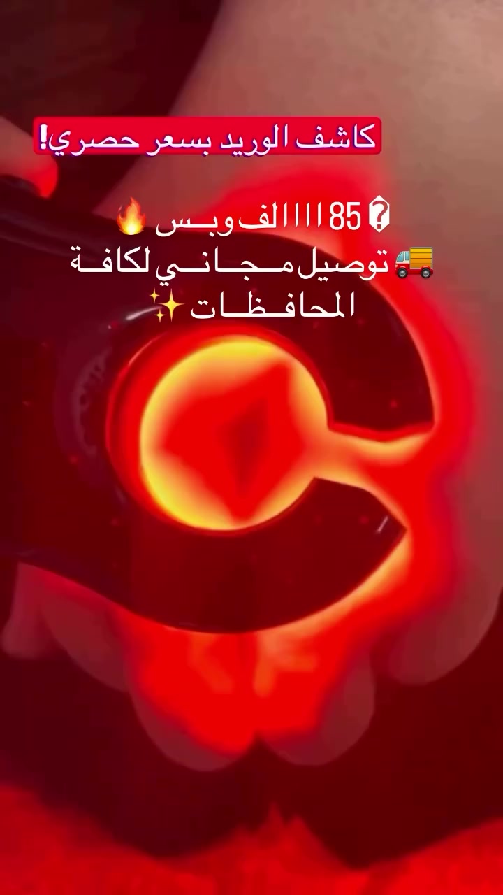 �✨ عرض بمناسبة شهر رمضان المبارك ✨🌙

بمناسبة الشهر الفضيل، تقدم لكم نوفا ميديكال للمستلزمات الطبية عرضاً مميزاً على:

🎯 جهاز كاشف الوريد الاحترافي
دقة عالية – عملي – مناسب للمراكز والعيادات

🔥 السعر: 85 ألف دينار عراقي فقط 🔥
🚚 توصيل مجاني إلى جميع المحافظات

📦 العرض مستمر حتى نفاذ الكمية
⚠️ الكمية محدودة

🏥 خانقين، شارع المزرعة، قرب جامع الهداية، مقابل حمزة للأعراس
📞 ***********

📩 سارع بالحجز واستفد من عرض رمضان المبارك 🌙

#نوفا_ميديكال #عروض_رمضان #مستلزمات_طبية #خانقين #توصيل_مجاني
