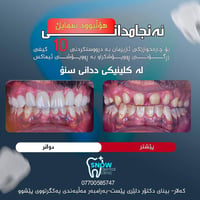 هۆڵیوود سمایڵ • دکتۆر دیاری عومەر • کەلار