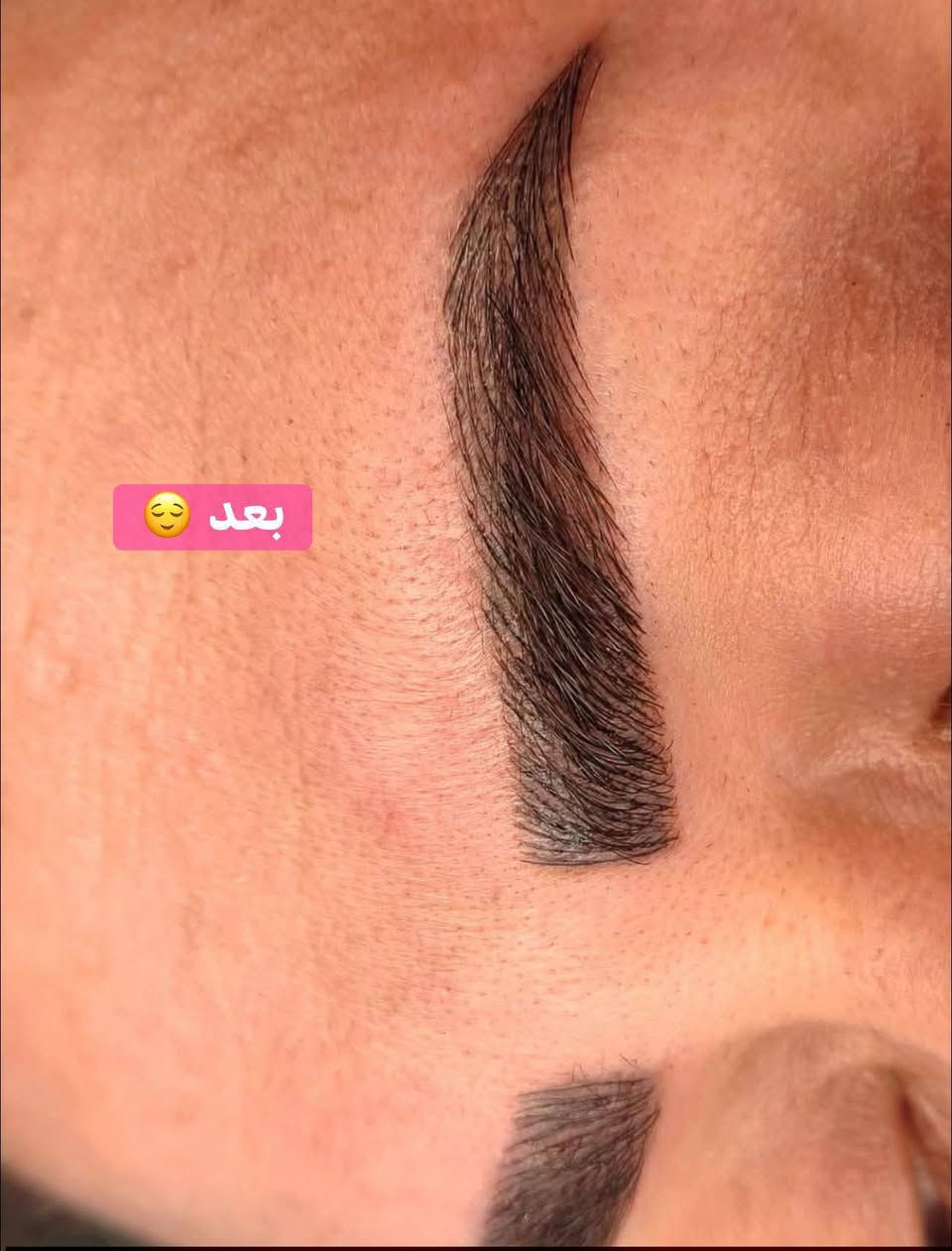 تحويل حاجب من ابلوك الى فايبروز
الشعب مقابل سوق المدينه عيادات الزهراء الطبيه للاستفسار 
*********** وات ساب
