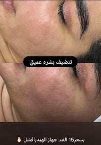 العنوان بغداد جسر ديالى القديم شارع 60 قرب معهد الزهراء النموذجي او جا...