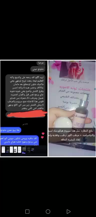 صباح الخير سحور هني أن شالله لايك وتعليق علمود المنشور يصعد 
صباح قلة ماء + قلة نوم + دوام وتعب = جفاف البشرة 
العلاج 🫠🫣❤️
💧 سيروم الهيالورنيك أسيد المتناهي الصغر + واطئ الجزيئات
يتغلغل للعمق… مو بس ترطيب سطحي
يحـبس الرطوبة داخل البشرة
ويعالج الجفاف من الجذور ✨
🌿 نياسيناميد + خلاصة لبان ذكر + عرق السوس
تفتيح هادئ
توحيد لون
شد ونضارة تبين من أول فترة 🌸
🥥 كريم النظارة باللوز وعرق السوس
مليان زيوت عشبية مغذية
يعالج أقوى جفاف
يرمم البشرة ويخليها ناعمة، مرنة، وتلمع صحة 💖
🔒 ثنائي مثالي
سيروم يشتغل من الداخل
وكريم يقفل الترطيب ويعطي نظارة تدوم
لا تشقق ✖️ لا بهتان ✖️
✨ إذا بشرتچ عطشانة ومتعبة
هذا الحل… جربي وراح تحسين الفرق 👌💦
كل الي جربو شافو فرق قوووي 
عرض فقط ب12 بكج كامل


**إذا كنت صاحب هذا الإعلان وتريد حذفه لأي سبب، رجاءا أرسل رسالة إلى الدعم الفني**