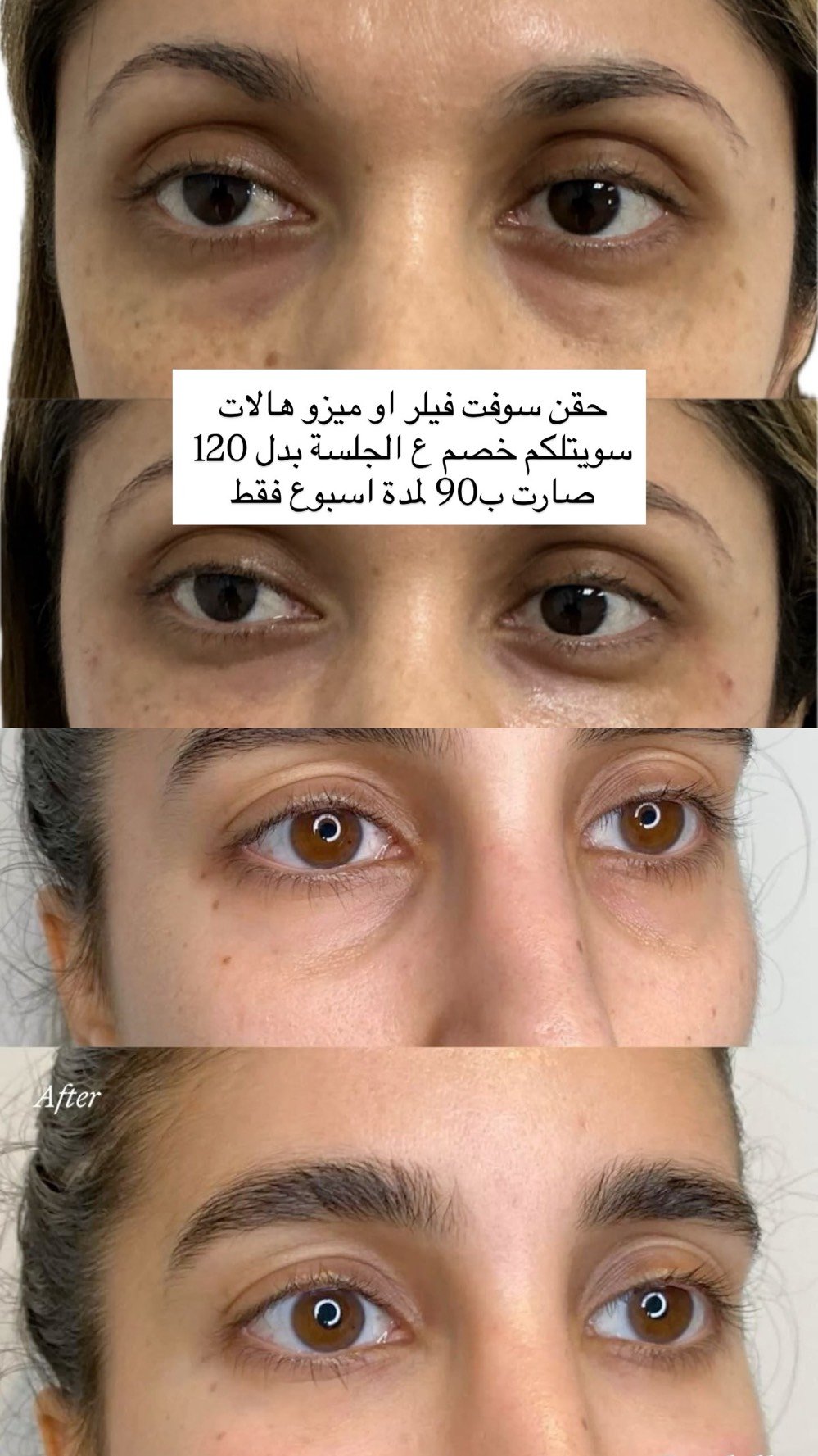 للتواصل والحجز/ ***********
زيونة/ 710 خدمي دريم ستي 
عيادة glow by raneen