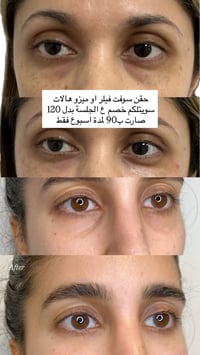 للتواصل والحجز/ 07852991170 زيونة/ 710 خدمي دريم ستي  عيادة glow by ra...