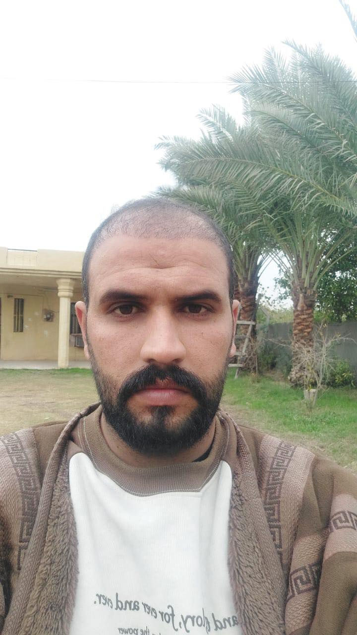 💰 السعر يبدأ من 650 - 850 الف حسب مساحة الصلع 
🔴 العملية تُجرى على يد كادر طبي مختص (وليس خبير)

حفاظاً على صحتكم نستخدم احدث التقنيات 
❇️ الزرع بتقنية حجر الزفير (حصريًا)
❇️ و القطف بتقنية الاقتطاف FUE الأحدث عالميًا

🔹 زراعة 6D و3D
🔹 للرجال والنساء
🔹 تشمل:
 • زراعة شعر الرأس
 • اللحية،شارب 
 • الحواجب
 • الحروق والندوب

⚡️ مدة العملية: لا تتجاوز 8 ساعات
⚡️ عدد البصيلات مفتوح دون الضرر بالمانحة 
⚡️ التخدير: موضعي وبدون ألم ✔️

⸻

🎁 يشمل العرض مجانًا:

✅ المعاينة والفحوصات قبل العملية 🔬🧪
✅ 8 جلسات بلازما (منشأ إيطالي) 💉
✅ 8 جلسات ميزوثيرابي (إسباني – فيتامينات، أحماض، معادن) 💉
✅ غسل الشعر يوميًا بعد الزراعة
✅ حقيبة علاجية متكاملة بعد العملية 💊
✅ وجبة طعام للمريض 🍔
✅ شهادة ضمان مدى الحياة
✅ شامبو طبي
✅جلستين نضارة للبشرة
⸻

مرحباً استاذ 💟
للاستفسار مع مختصين زراعة الشعر في مركزنا عبر واتس اب يرجى الضغط هنا 👈🏻 https://wa.me/9647772044099


**إذا كنت صاحب هذا الإعلان وتريد حذفه لأي سبب، رجاءا أرسل رسالة إلى الدعم الفني**