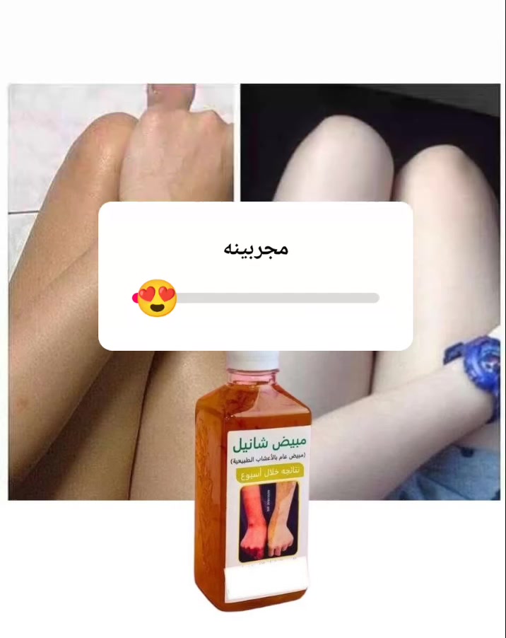 شراب  شانيل غني عن التعريف 🫨 مبيض عام لجسم والوجه 📍  حرفيا ايجنن بنات 

يوجد توصيل لجميع محافظات العراق 
لايك_كومنت #تعليقات #اكسبلور #لقطة 

سعر 12


**إذا كنت صاحب هذا الإعلان وتريد حذفه لأي سبب، رجاءا أرسل رسالة إلى الدعم الفني**