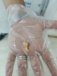 عيادة أسنان • قلع سن العقل • حشوات تجميلية
