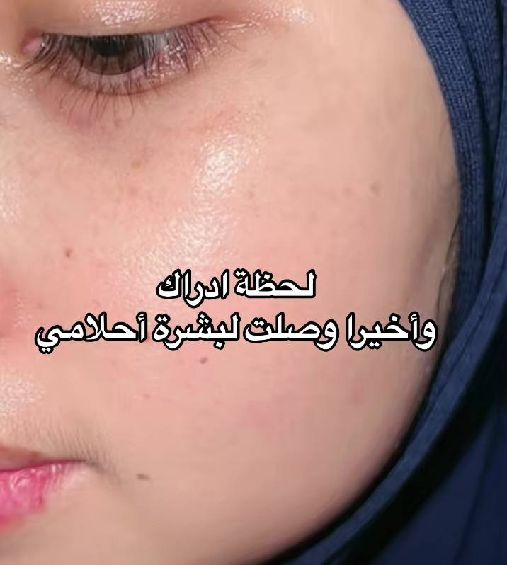 بنات لحكو ع عرض العيد🥳😍فقط للكريم الكولاجين صار التوصيل مجاني بكل محافضات العراق والسعر ١٥ فقط 
يخلص العرض اول يوم العيد 🥳😍 لا يفوتكم العرض يخبل والكريييم احله اكيد 🫶🪬♥️♥️


**إذا كنت صاحب هذا الإعلان وتريد حذفه لأي سبب، رجاءا أرسل رسالة إلى الدعم الفني**