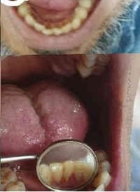 يوم الاثنين عياده التنظيف في عيادات جامعه البيان لحجز موعد وات ساب 078...