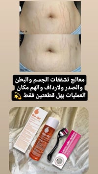 تحفيز الكولاجين • ندبات حب الشباب • علاج تشققات