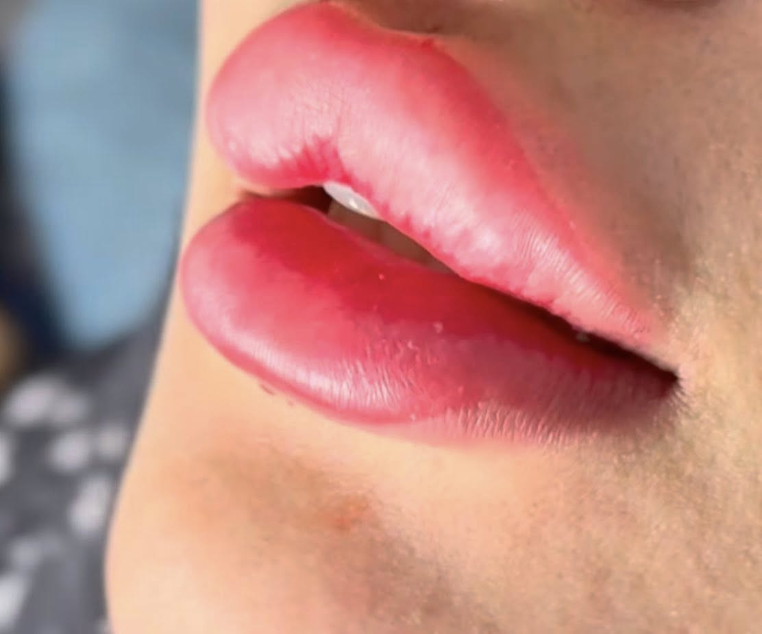 🌙عروض رمضان منا عيد فطر مبارك مستمره وياكم صالون جمانه بنات عروض خيال ورخيص وشغل كوله بي ضمان  قسم أضافر ول عروض اكرلك هوه بنا جل اكستنشن فول دزاين ٢٠ ألف جل اكس ١٥ ألف تركيب ١٠ ألف سترونك وجلش ودزاين ١٥ اكرلك قدم 🦶 ١٠ ألف فول دزاين عروض رموش 👁️بكل تقنيات رموش ❣️شعر طبيعي ميه بل ميه سعر ١٥ ألف طرفيه ١٠ ألف عروض قسم حقن بنات فلر 👄شفه كوري أي 🩷رسمه بالج تطلع ٢٥ ألف سيسي تغير شامل ١٥٠ ألف كل رسمات نضار ٢٠ ألف بكل تقنيات بوتكس ٥٠ ألف غازي عروض قسم شعر صبغ حمرات جميع أطوال شعر ٥٠ ألف ماعده قصير ٣٠ ميش ٢٥ معالج بارد ٢٠ ألف تسريح شعر سعر بعد معاينه بنات ماده فيرزاده صبغ وقصر حسب طول 💛شعر ميش احمر حسب طول شعر بنات عروض تخلص اول يوم عيد فطر لحكو متلكون هيج عروض 💞انتضركم تنوروني بكل حب زبوناتي بنات خصل مايكروه شعر طبيعي ١٠ خصل ب ٢٥ أي لون انتي تحبي متوفر


**إذا كنت صاحب هذا الإعلان وتريد حذفه لأي سبب، رجاءا أرسل رسالة إلى الدعم الفني**