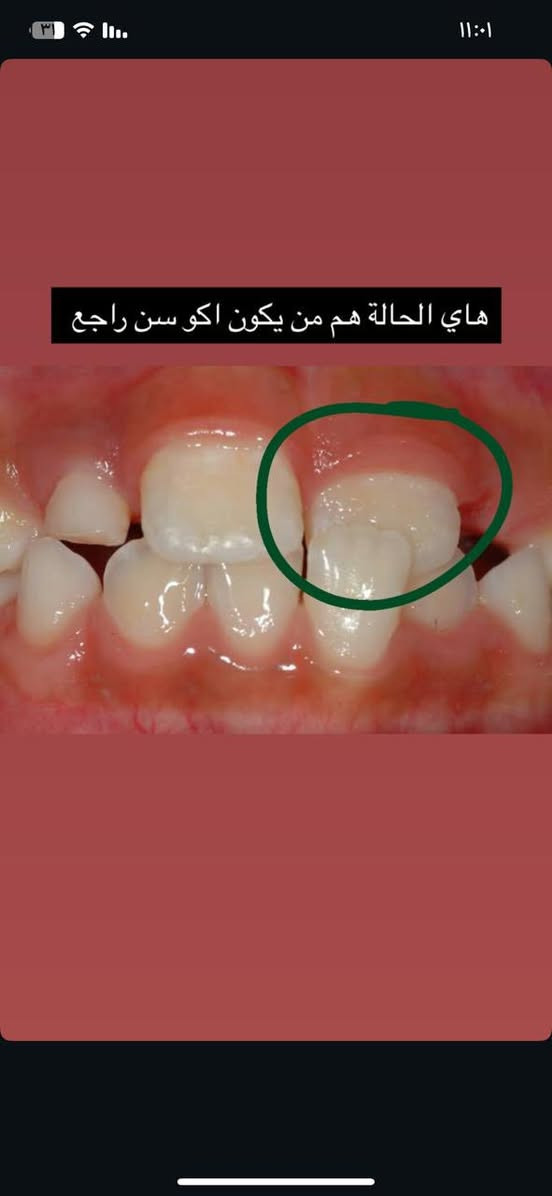 للاطفال من بعمر 9 او 10 الي عندهم مثل الحاله الي بالصورة تقويم مجاني بالبصرة والزبير للتوصل ***********
