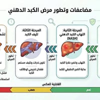 مرض الكبد الدهني هو حالة شائعة تحدث نتيجة تراكم كميات زائدة من الدهون ...