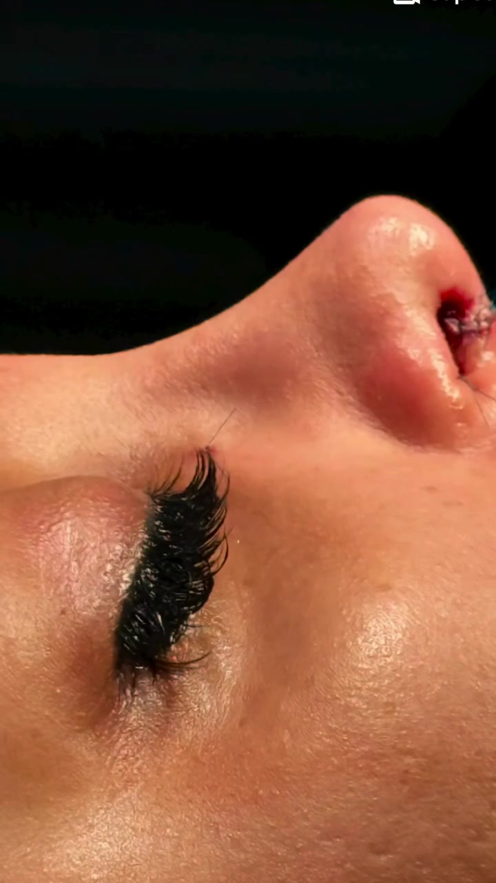 سلام علیکم.
معاکم...  محمد
مترجم طبیه وخبير في  علاج العيون وعمليات التجميل فی مشهد للإجابة عن إستفساراتكم وأسئلتكم أرجو مراسلتي عبرالخاص مع الشكر والتقدير .مع کافه الخدمات الطبیه🙏💐

*********** واتساب
