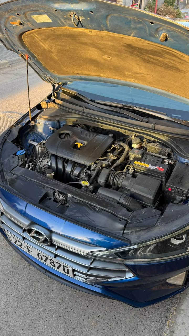 النترا 2020 
ليبل واحد
سيارة جاهزة وجديدة 
ماشية 80 الف ميل قابل للزيادة 
حادث جدا بسيط 
بدون ايرباك بدون دواخل 
شاصي . لغد .  مكفول
بدون صبغ فقط جزء من البنيد 
محرك 2000 دوش
كير at ايتي المرغوب
رقم اربيل جديد 
سنوية 2031
هزة 2026
صدر جديد 
دوشمة جديدة 
منظومة عدسة لايت زنون
حساسات و بلكات ومجاول جديد
السعر 128 مجال بسيط 
مكان السيارة بغداد
*********** بغداد, العراق
