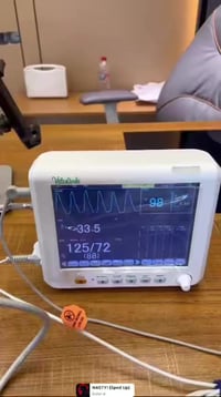 مونيتر بيشنت توفر وبجميع الاحجام   من 8انج الى 17  صيني المنشأ   وباسع...