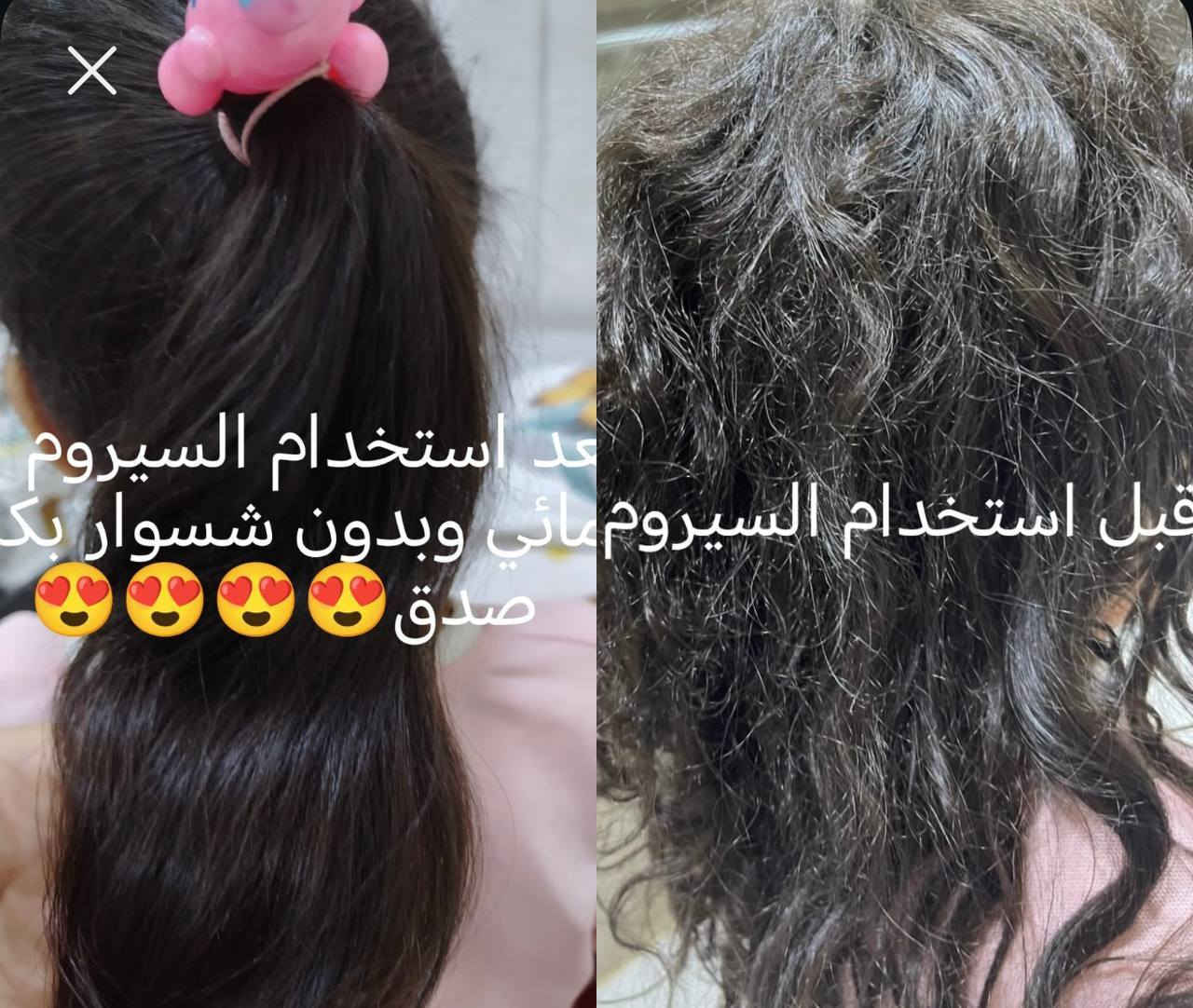 تجربه زبونتي لسيروم الشعر 🌺🌺🌷♥️❤️💜


**إذا كنت صاحب هذا الإعلان وتريد حذفه لأي سبب، رجاءا أرسل رسالة إلى الدعم الفني**