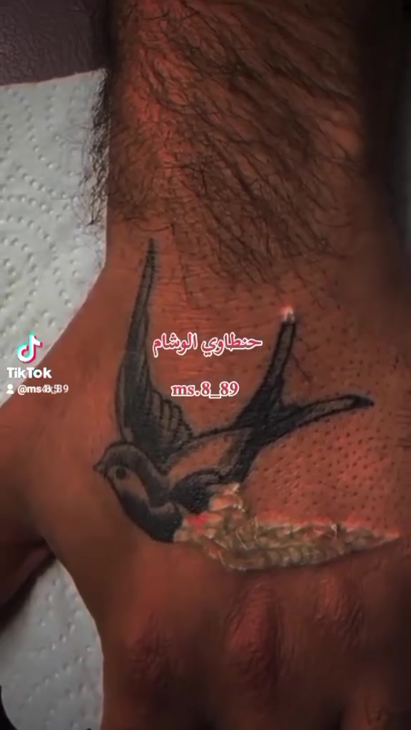 #ازاله_وشم_بليزر #نتيجه_من_اول_جلسه
العنوان: ڪوت زويريجات

*********** واتساب 

ms_8_89 /تلكرام

ms.8_89/ انستا
 
تيك توك /ms.8_89
