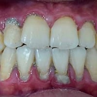 عيادات جامعة بابل • علاج اسنان مجاني • حي الاسكان