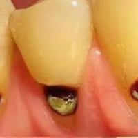 اللي عنده هيج تسوسات و يكدر يجي لليرموك يراسلني 07821538484 علما انو ا...