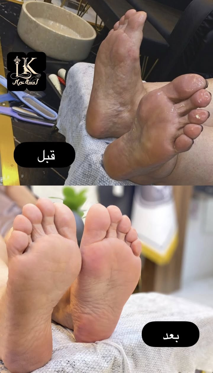 مستمره عروضات العيد من لمسة خيال ❤️

تنظيف قدم ملكي 15
تنظيف يد ملكي 10

 العنوان موصل حي الوحده سايدين مقابل جامع الصابرين 
( جامع الشيخ عبد القادر الكيلاني ) للحجز خاص أو الاتصال ع الرقم 
***********

