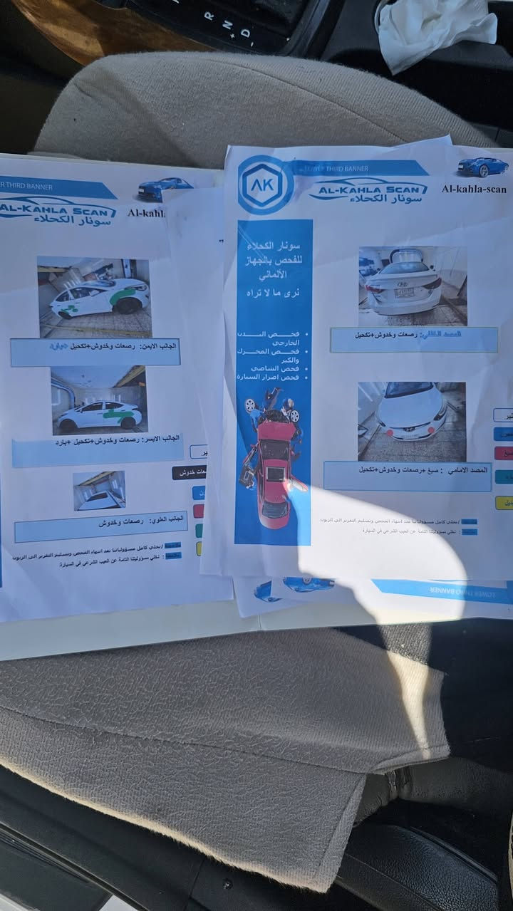 لسعر النتره ٢٠١٥ خليجي كفاله عامه من صبغ وتبديل
لسونار مرفق  فقط بيه بارد مشر بل خظر كير ومحرك وتبريد خي من الله جاهزة ا لسعر ١١٥  للتصال ***********
