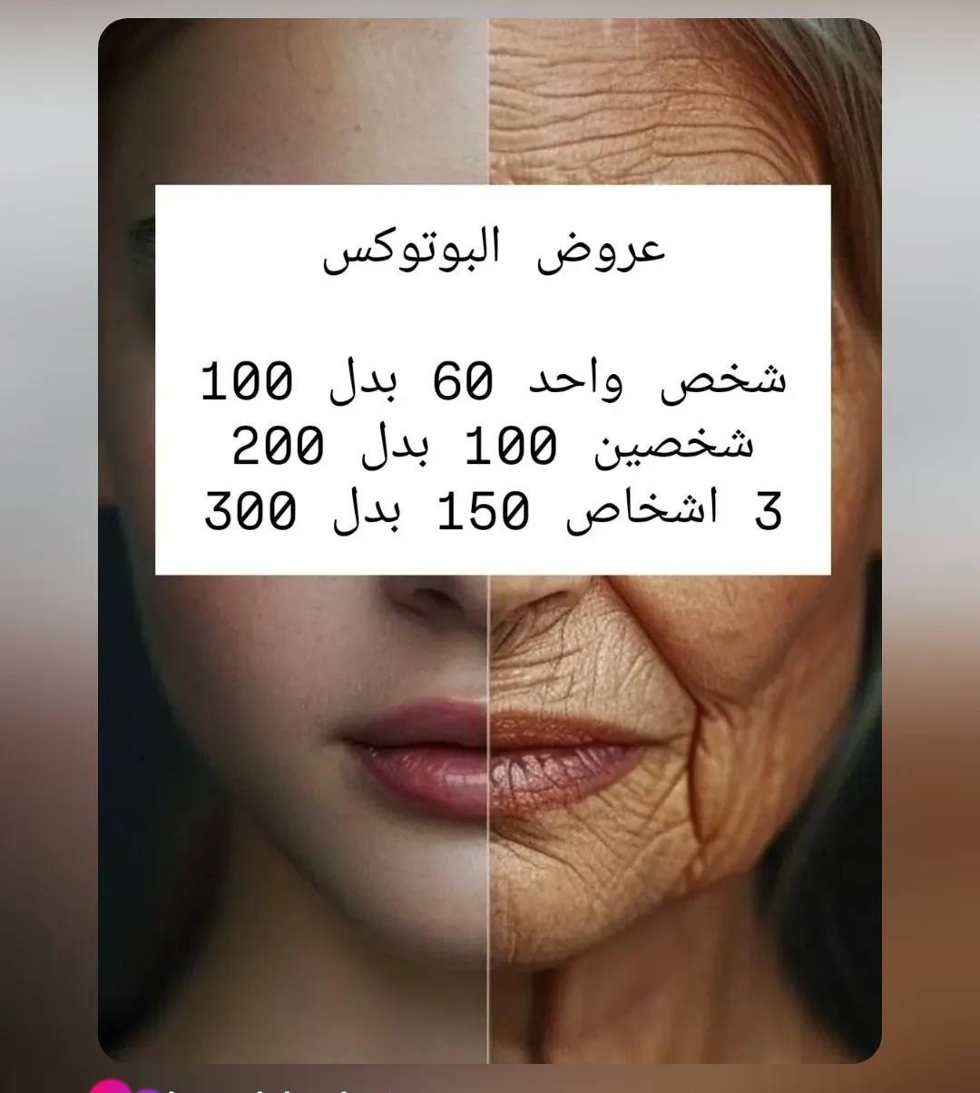عروض العيد مستمرة ❣️💉
ابرة نضارة هدية مع كل إجراء 
مع توفر تنظيف بشرة بأسعار رمزيه جدا 
للحجز والأستفسار ***********
