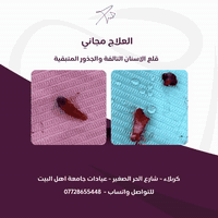 مجانا
واتساب ***********
