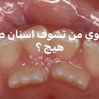 شتسوي من تشوف اسنان طفلك هيج ؟   د. احمد هلال ٠٧٨١٦٢٧٨٩٢٠  د. علي حسين...