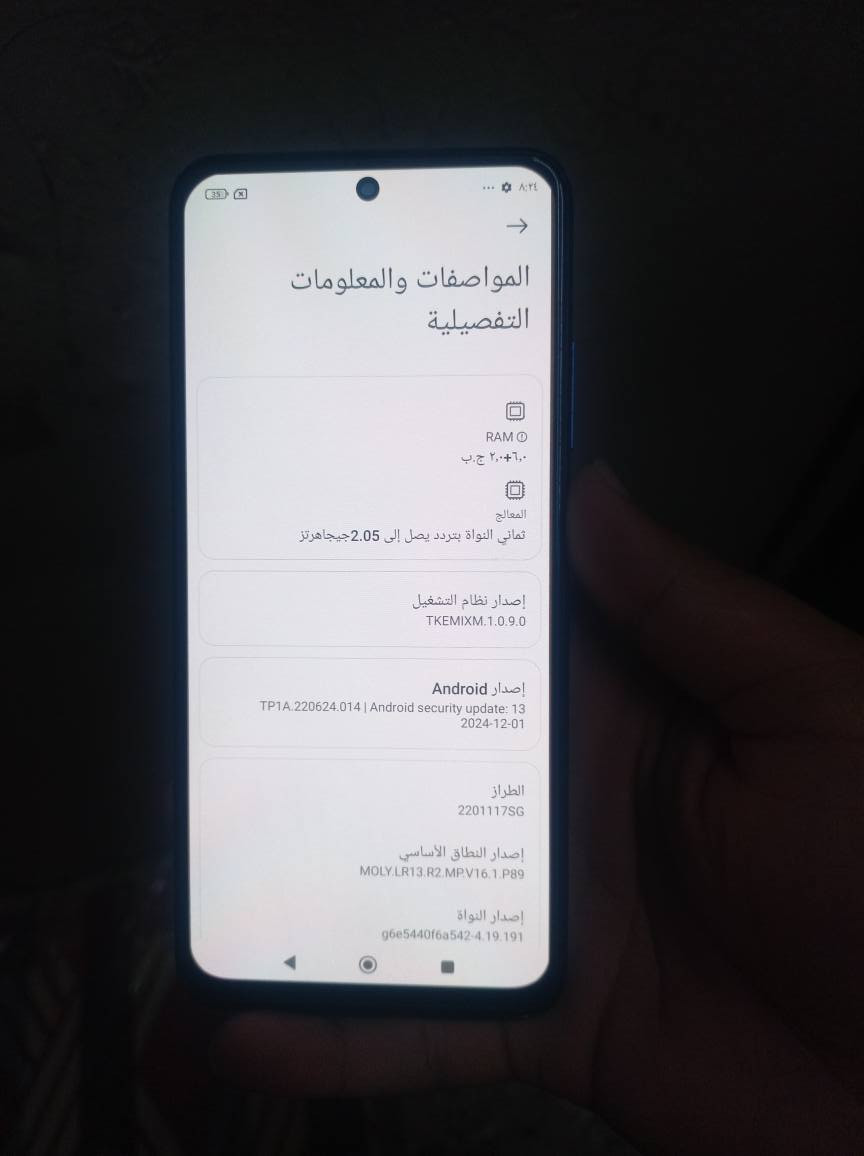 سلام عليكم لبيع Redmi Note 11 s ذاكرة 128 مكفول كلة شغال مبدل شاشة أصلية وكالة سعر 75 شراي يجي خاص لو يتصل *********** بغداد مدينة صدر بغداد, العراق
