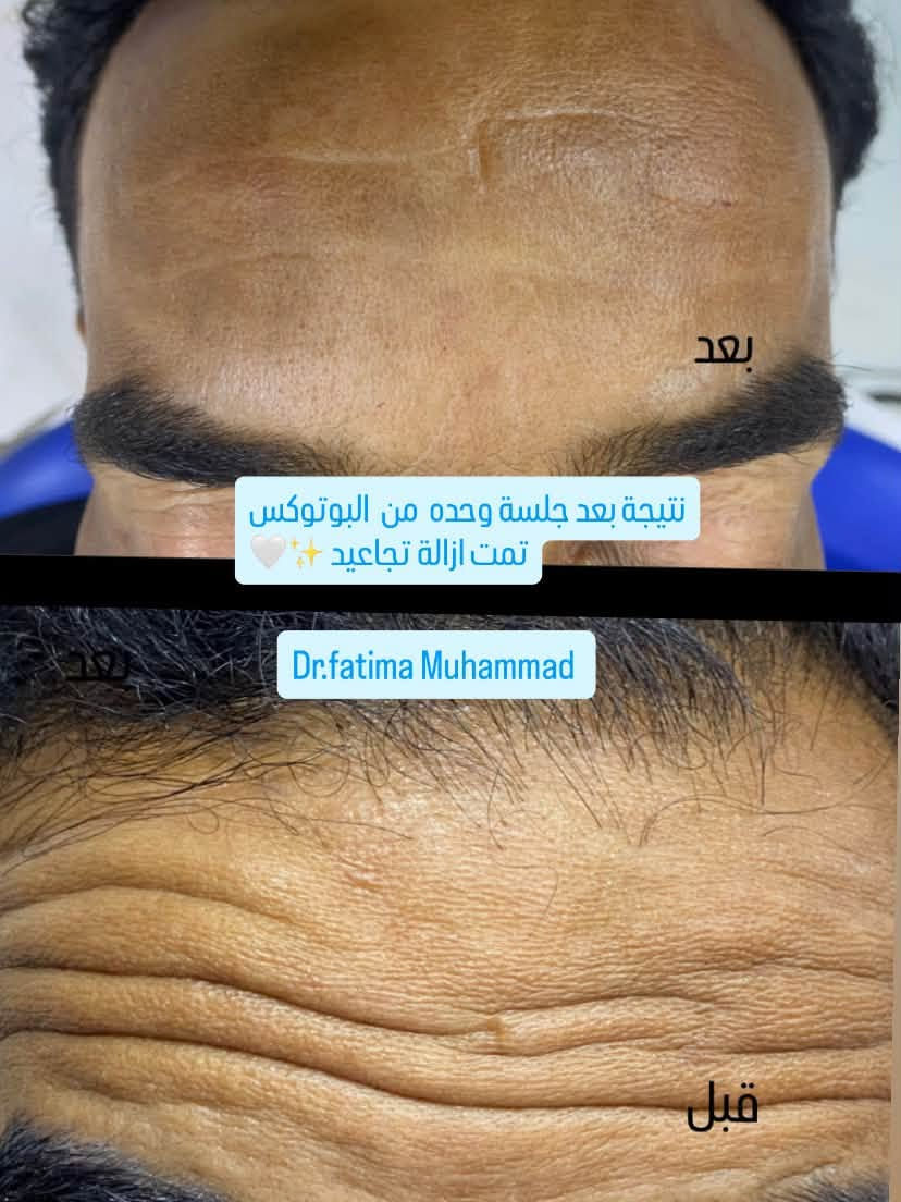 راسلونه للحجز ***********
